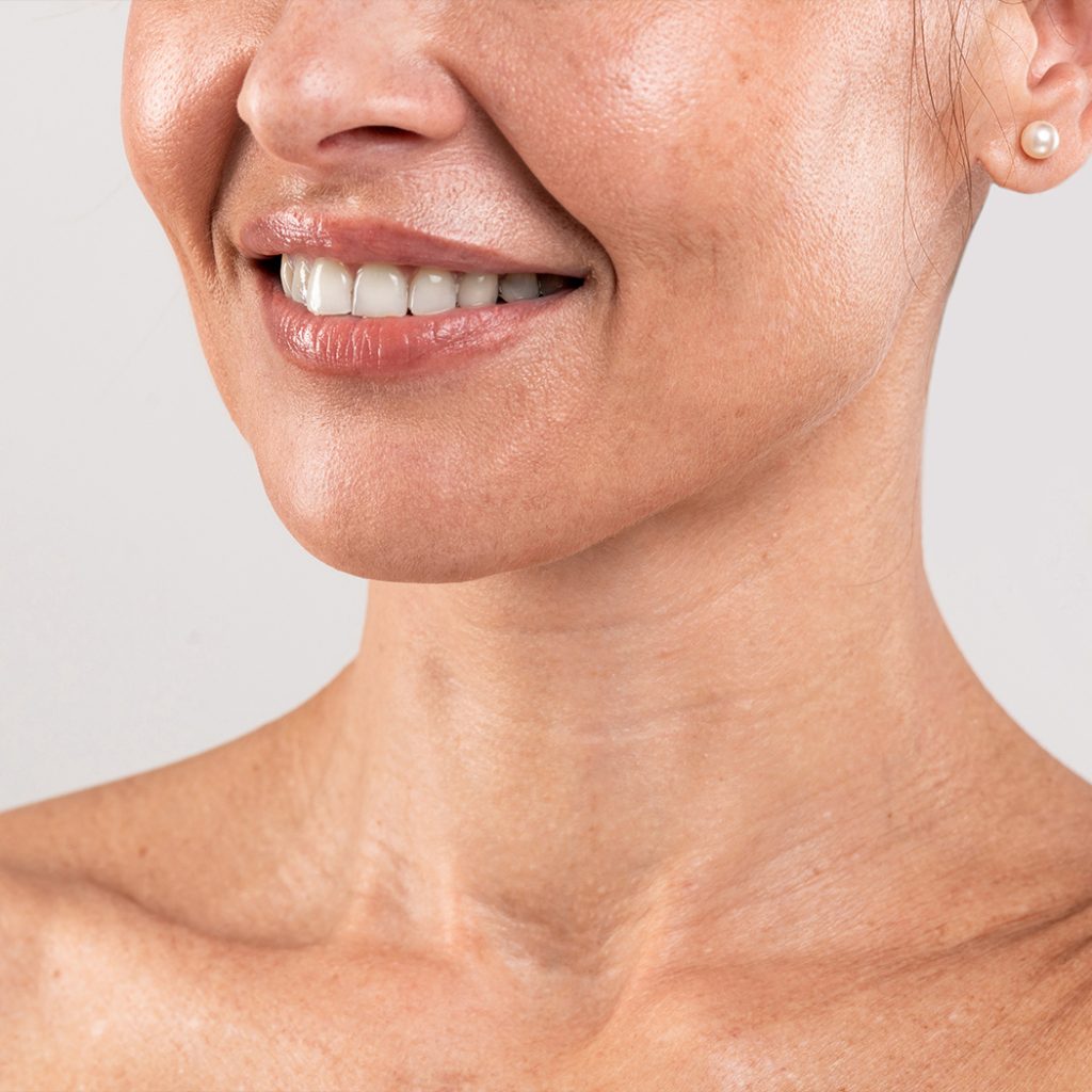 Woman's face and neck