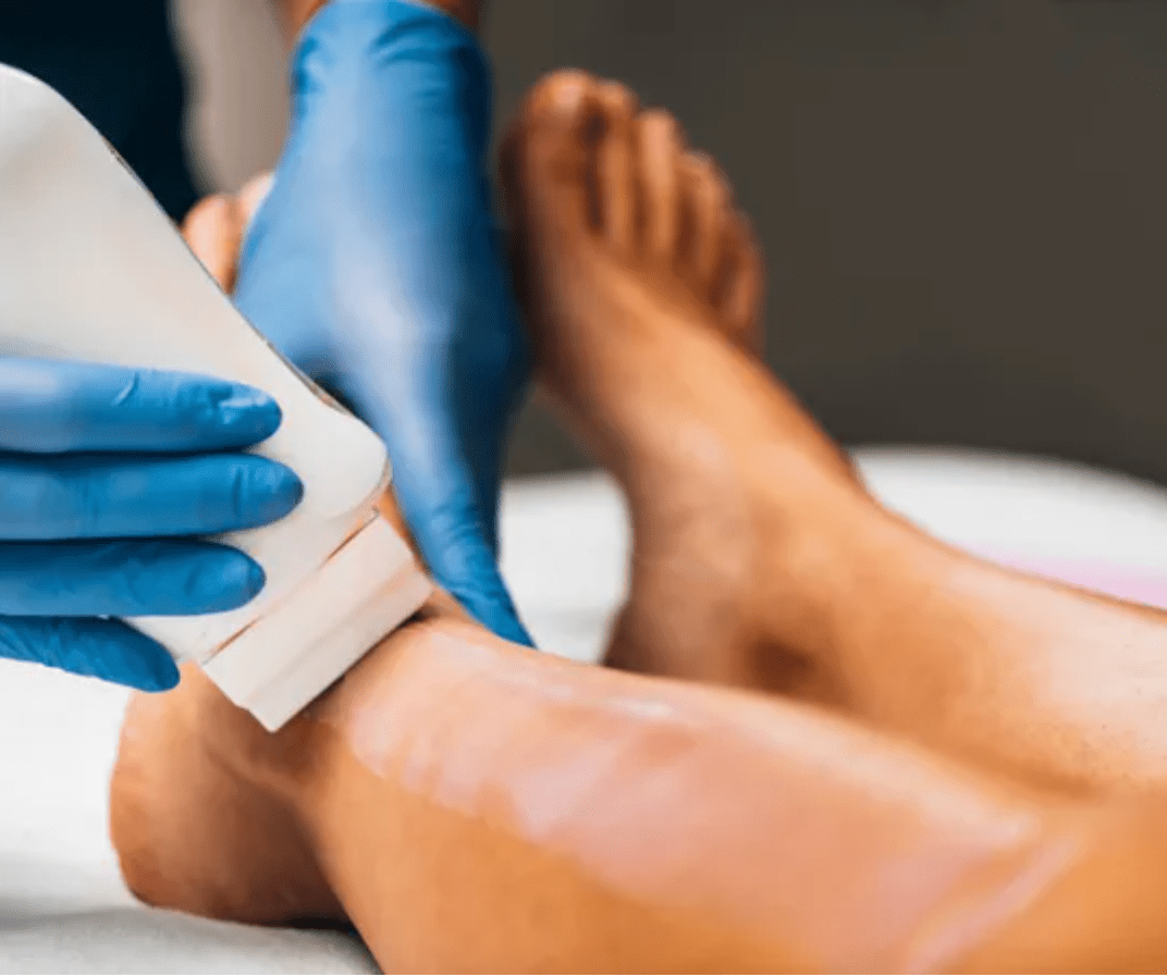 LEG LASER HAIR REMOVAL IN NYC