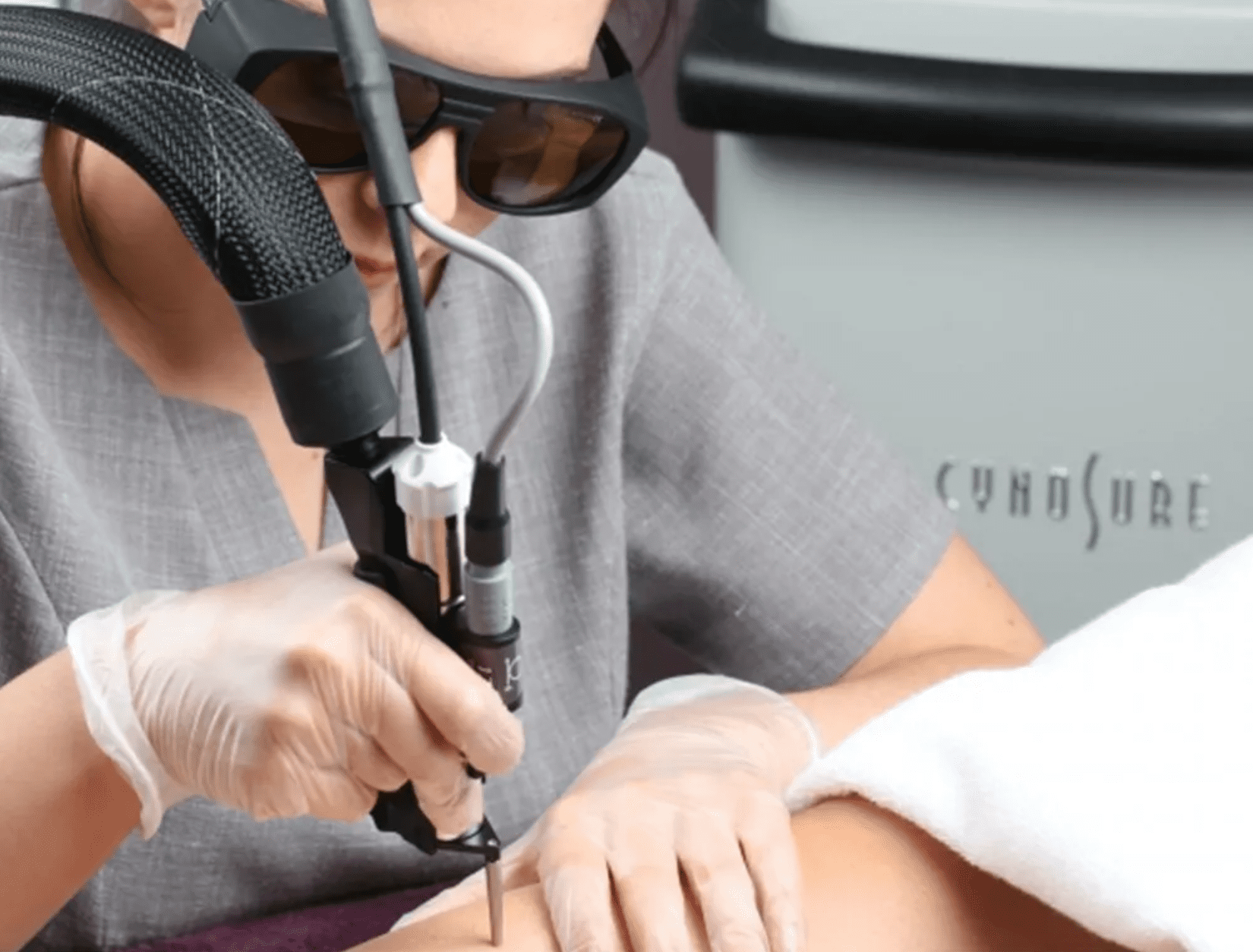 Cynosure treatment