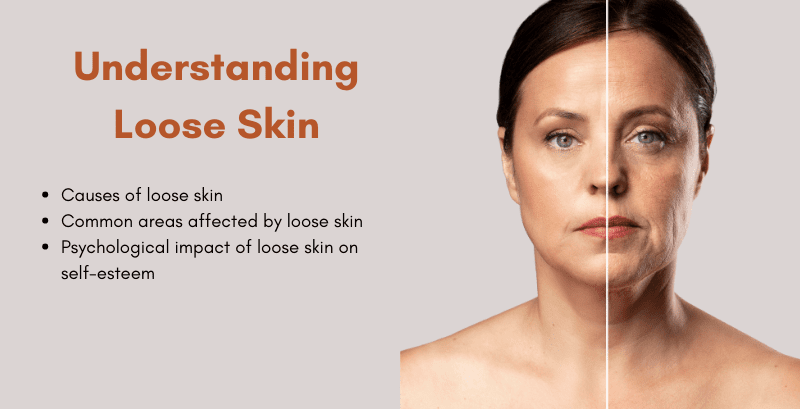 Understanding Loose Skin