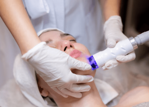 woman getting chin Laser Hair Removal
